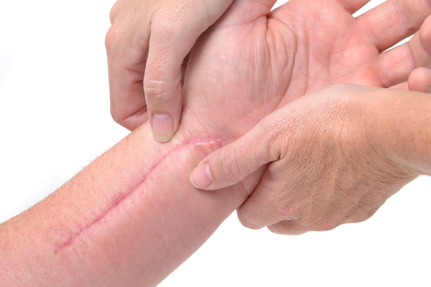 19.06.2024: Handtherapie Behandlung nach Verletzungen und Narben